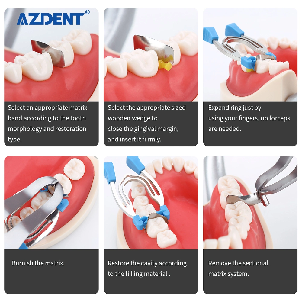 Good Price Azdent Dental Sectional Contoured Matrix Clip Matrices Clamps Wedges